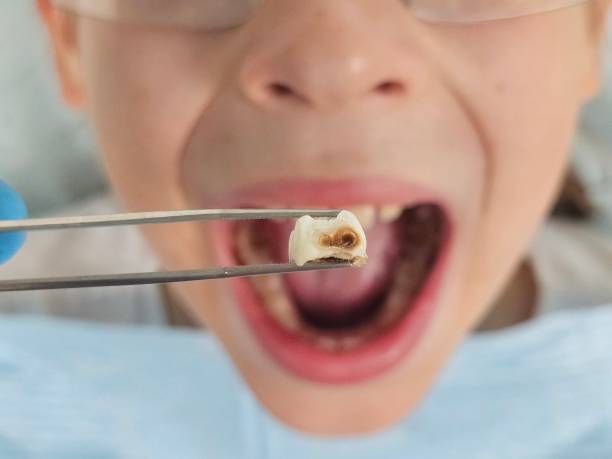 Best Broken Tooth Emergency  in Girardville, PA